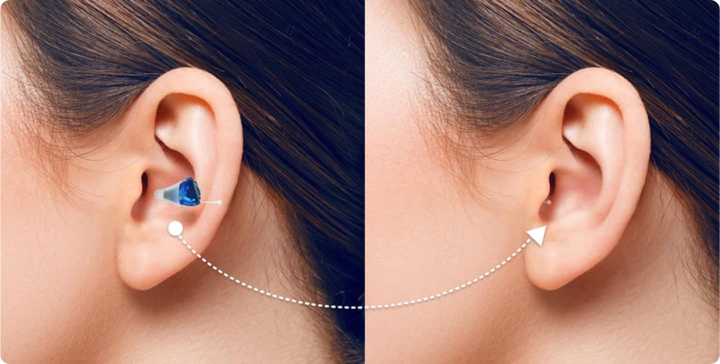 twee afbeeldingen zijn te zien van de het oor van een vrouw met bruin haar. In haar hoor is het in-het-oor hoortoestell te zien.