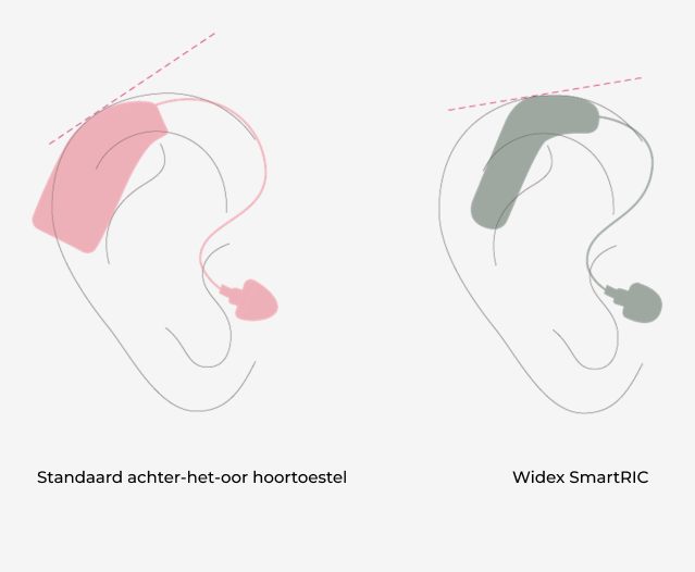 links is een oor te zien met een standaard hoortoestel en rechts is de widex smartric te zien